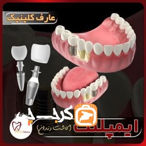کلینیک دندانپزشکی دکتر عارف