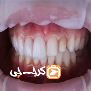 مطب دندانپزشکی دکتر نسرین عبدی