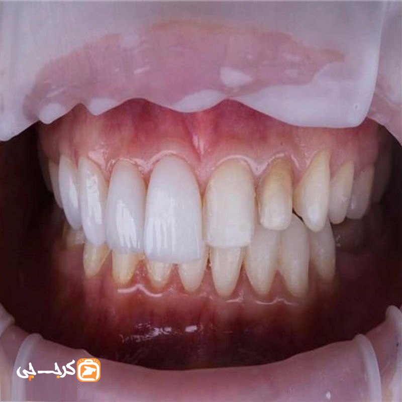 مطب دندانپزشکی دکتر نسرین عبدی