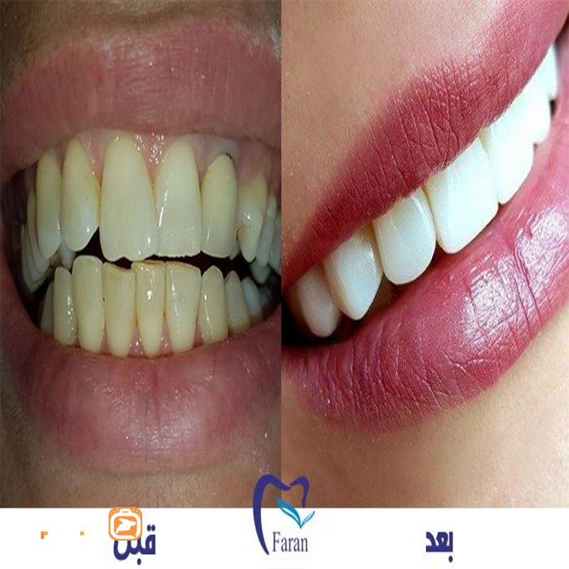 کلینیک دندانپزشکی آتیه