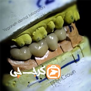 لابراتوار تخصصی پروتزهای دندانی یگانه